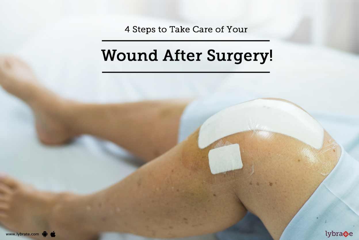 4 Steps to Take Care of Your Wound After Surgery!