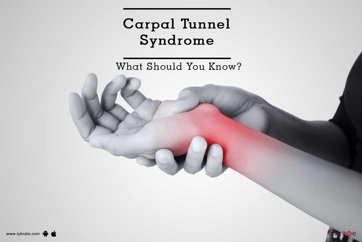 Carpal Tunnel Syndrome - What Should You Know?