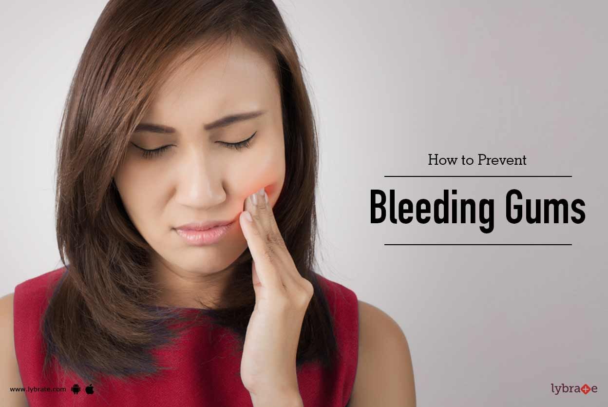 How to Prevent Bleeding of Gums