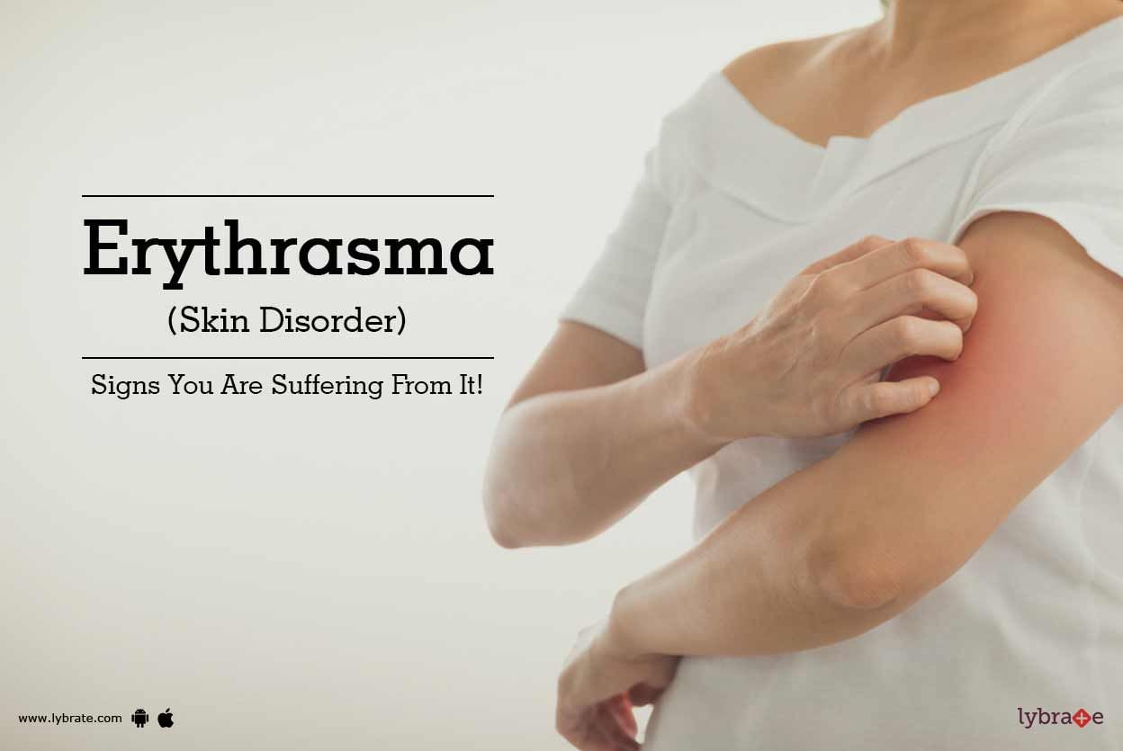 Erythrasma (Skin Disorder) - Signs You Are Suffering From It!