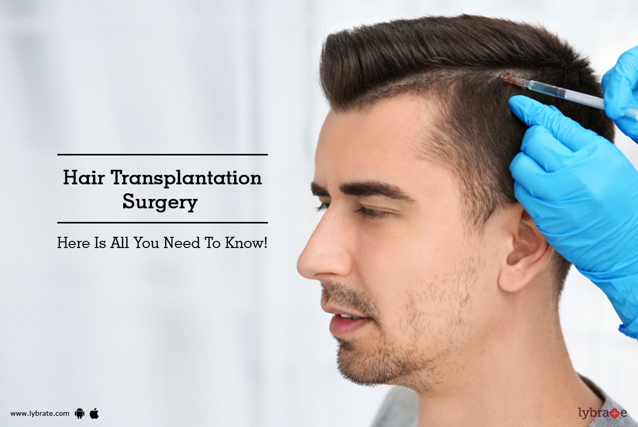 Hair Transplantation Surgery - Here Is All You Need To Know!