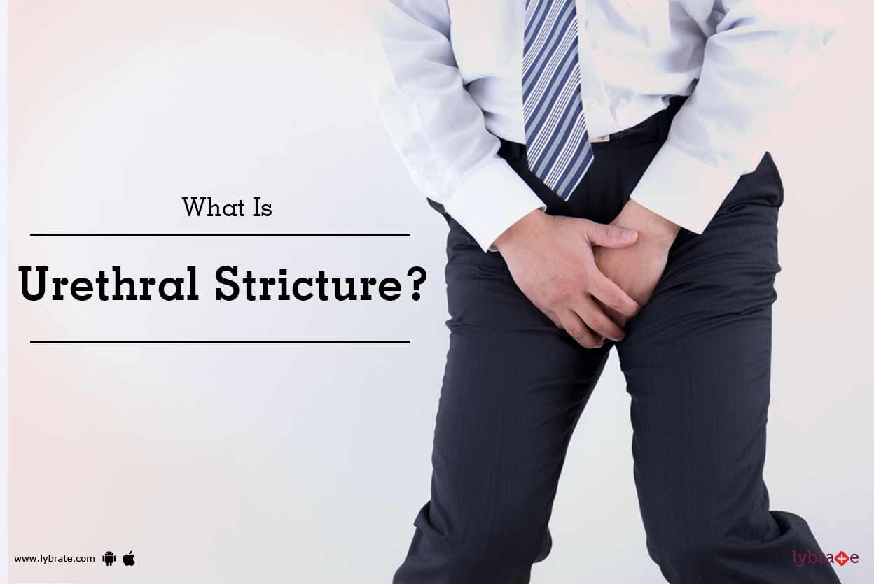 What Is Urethral Stricture?