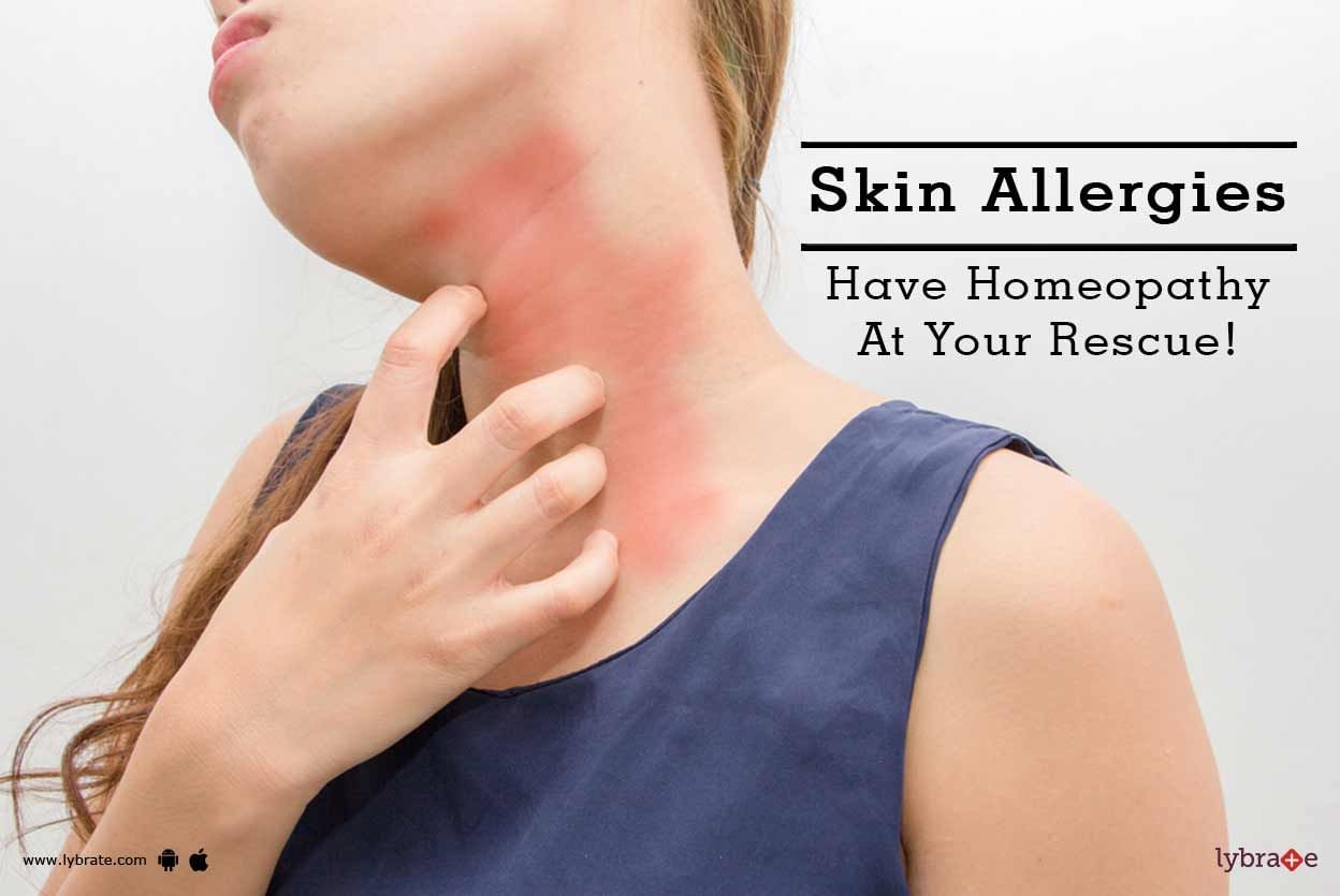 Skin Allergies - Have Homeopathy At Your Rescue!