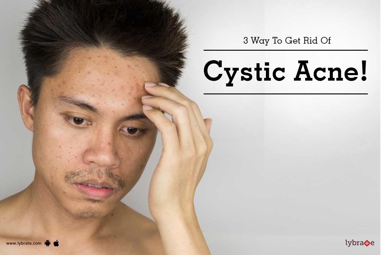 3 Ways To Get Rid Of Cystic Acne!
