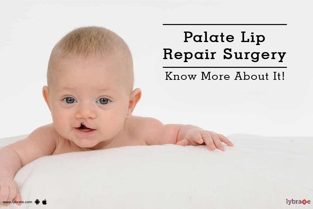 Palate Lip Repair Surgery - Know More About It!