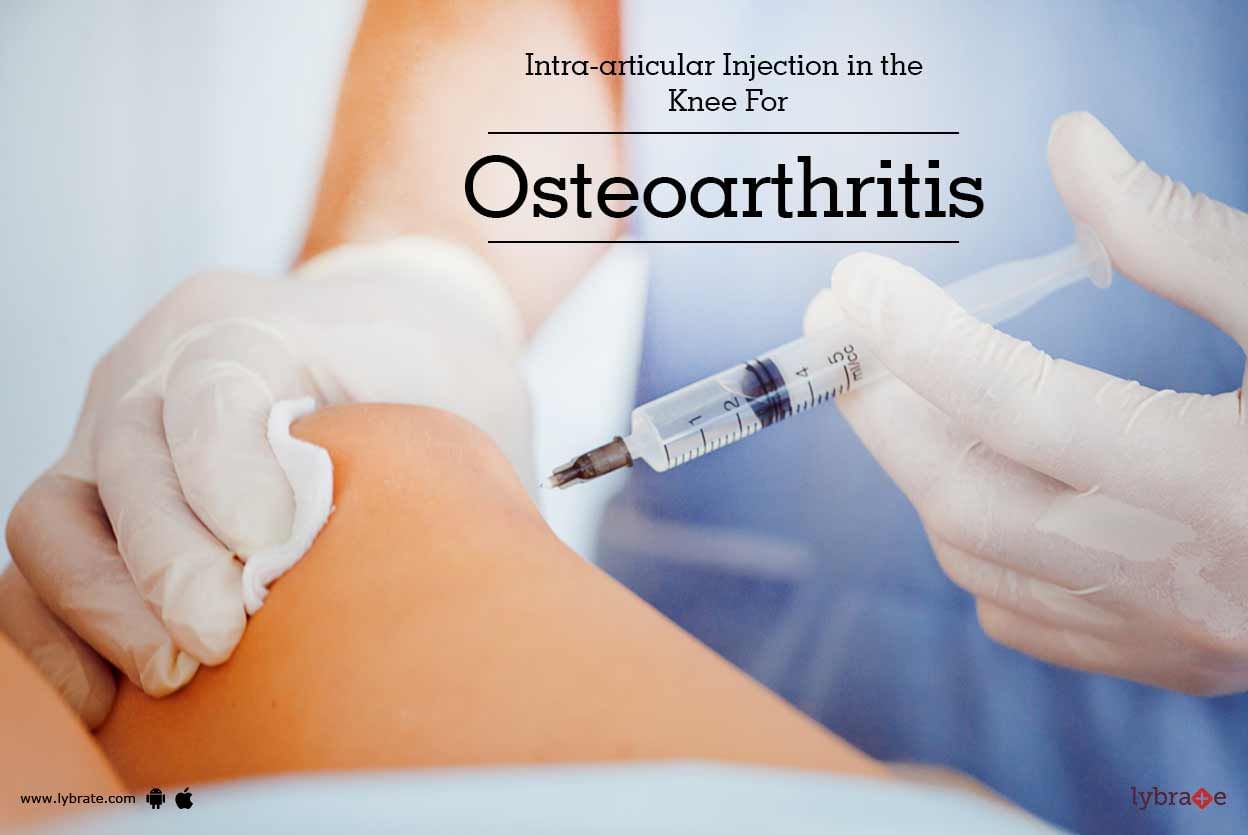 Intra-articular Injection in the Knee For Osteoarthritis