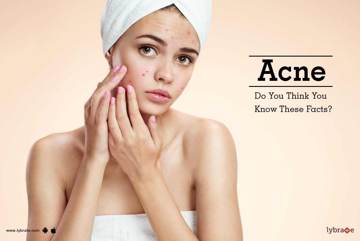 Acne - Do You Think You Know These Facts?