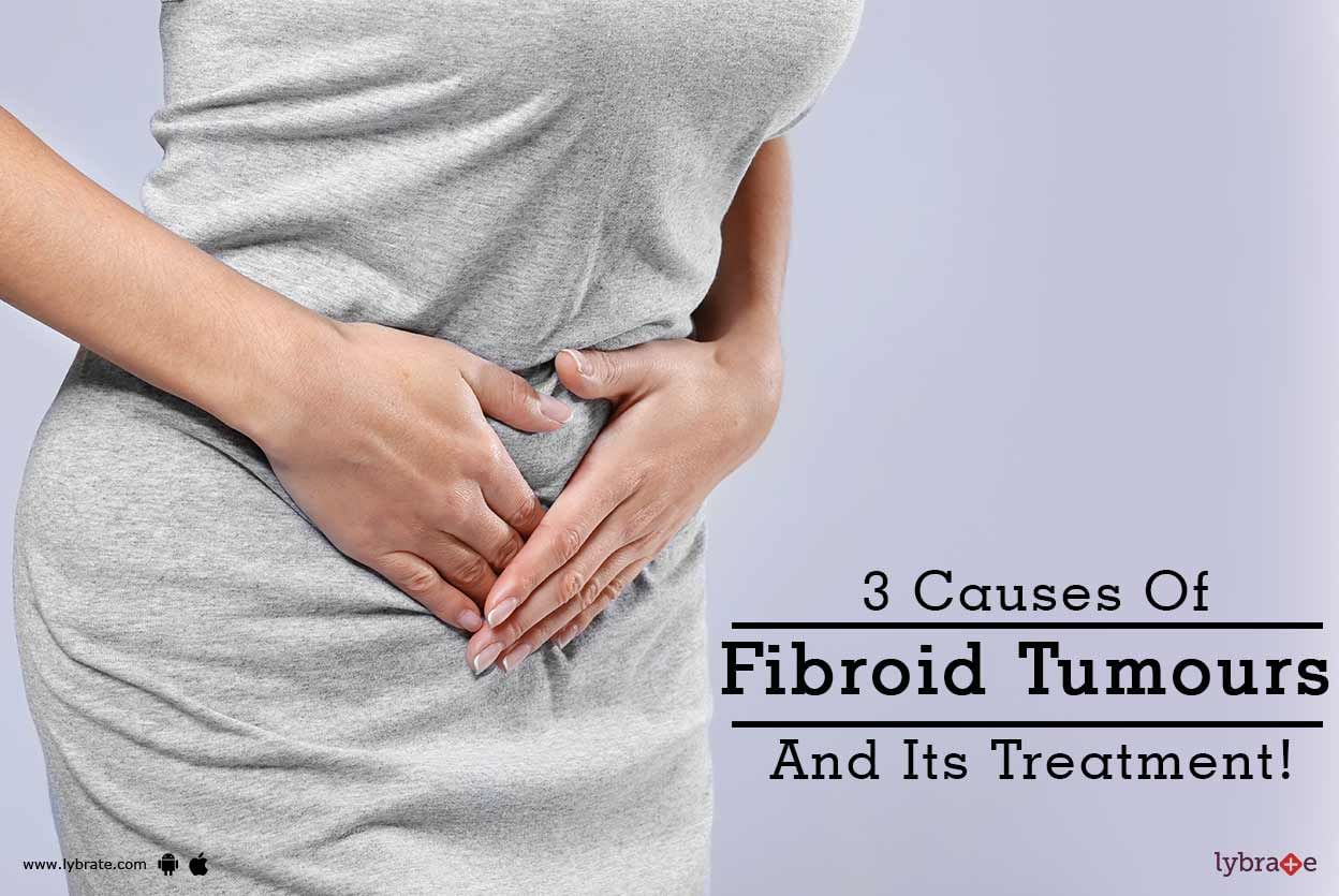 3 Causes Of Fibroid Tumours And Its Treatment!