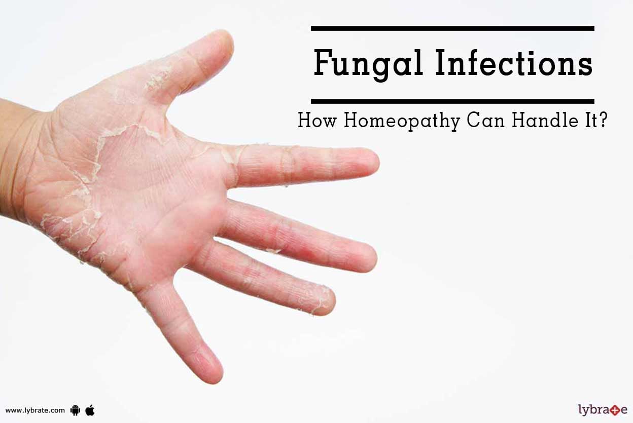 Fungal Infections - How Homeopathy Can Handle It?