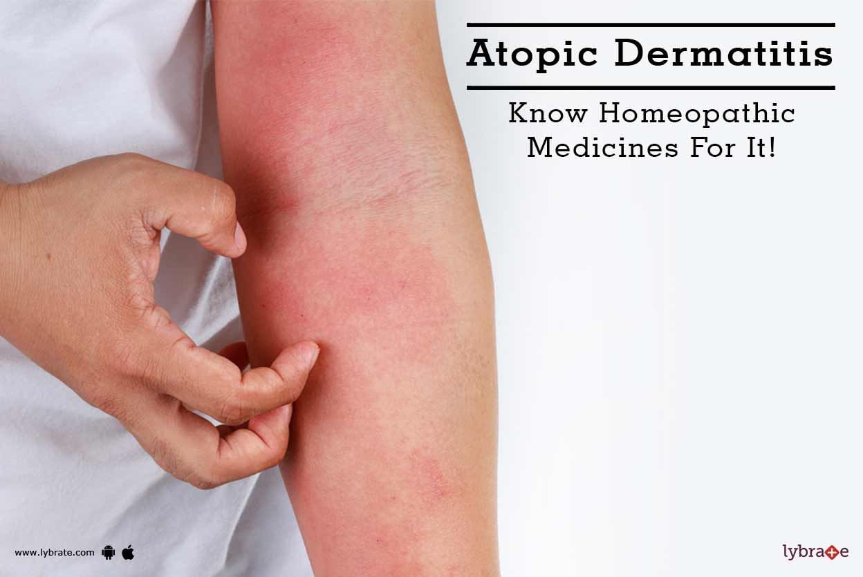 Atopic Dermatitis - Know Homeopathic Medicines For It!