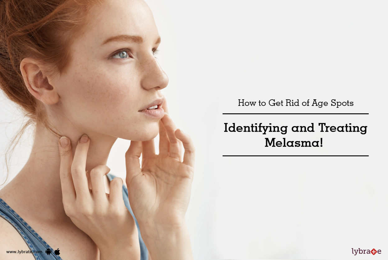 How to Get Rid of Age Spots: Identifying and Treating Melasma!