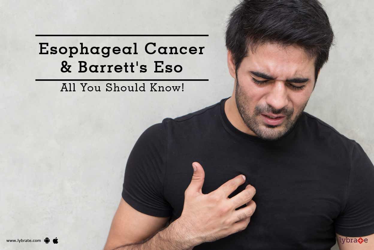 Esophageal Cancer & Barrett's Eso - All You Should Know!