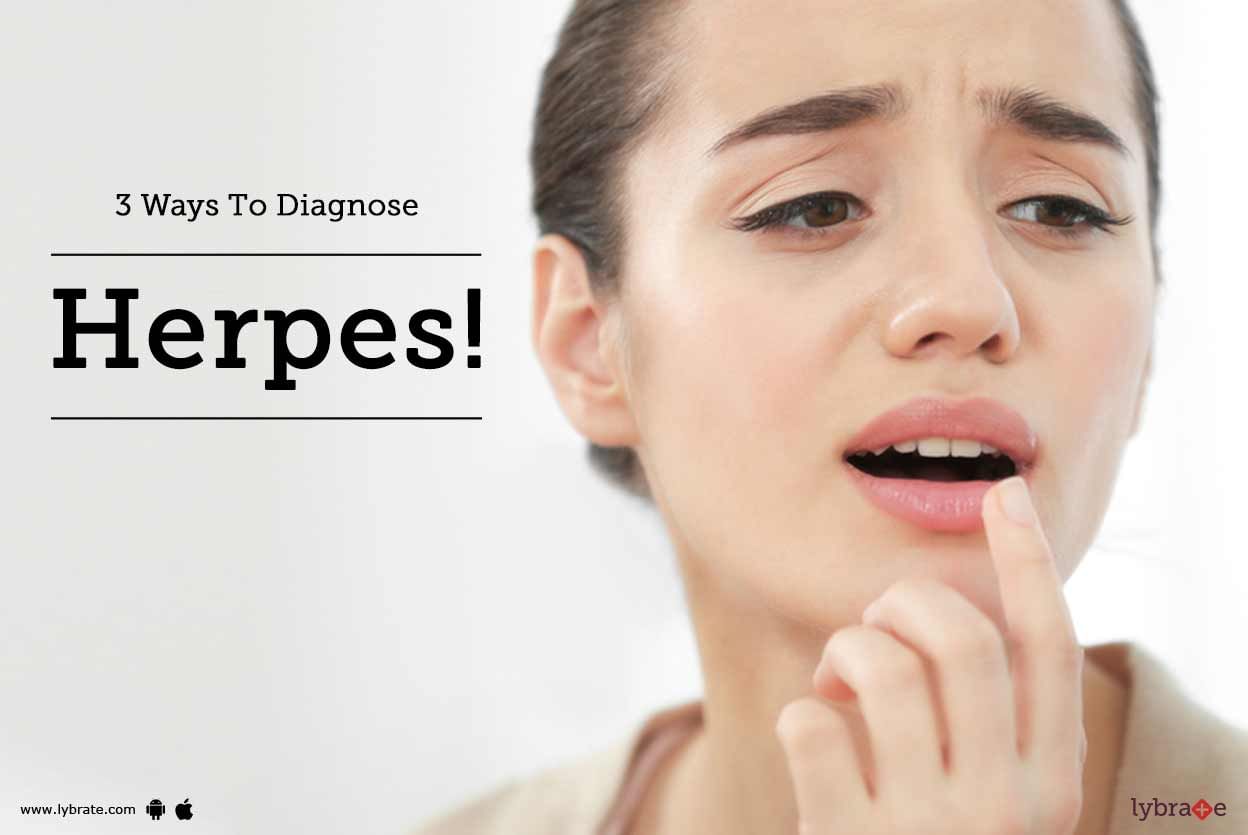 3 Ways To Diagnose Herpes!
