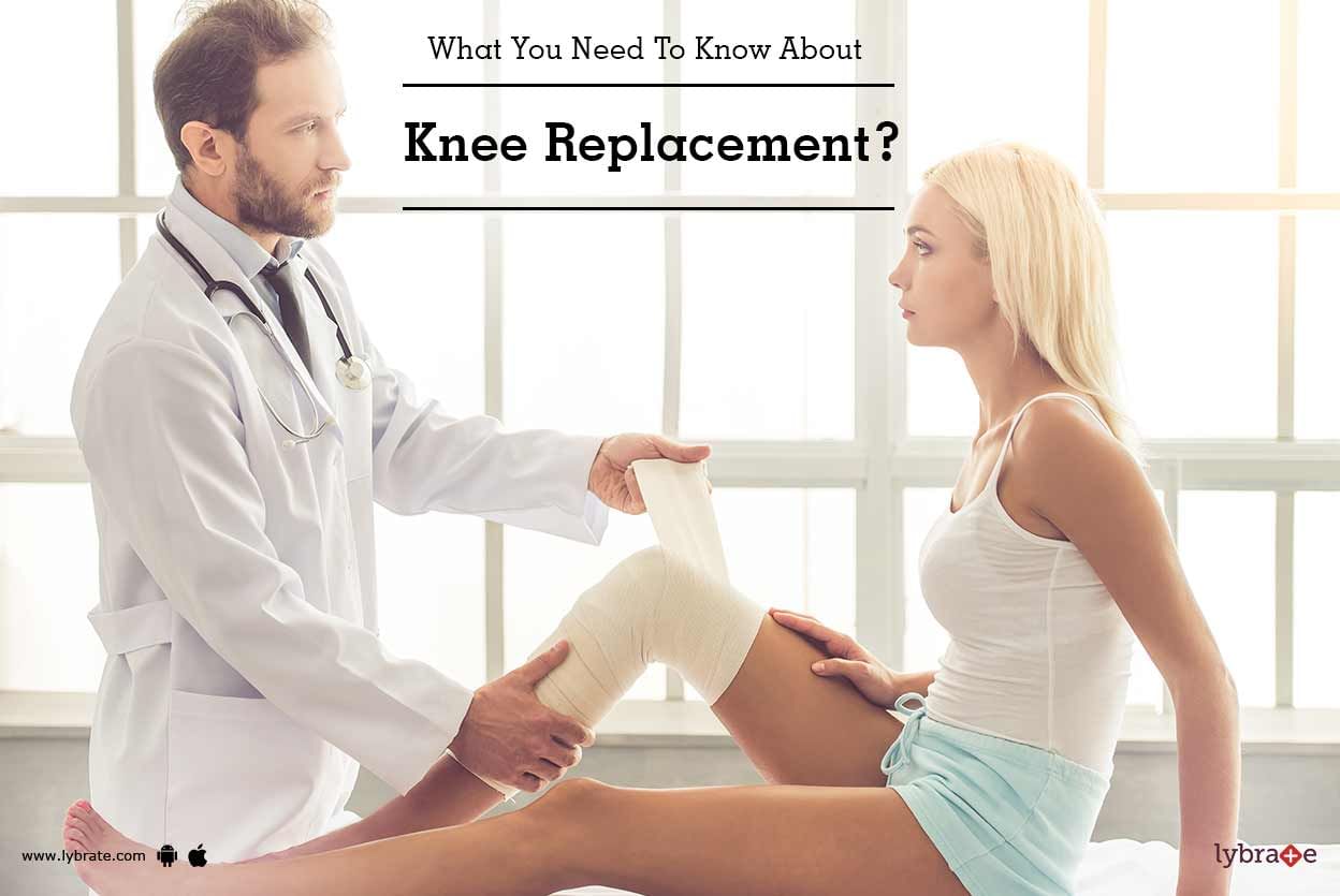 What You Need To Know About Knee Replacement?