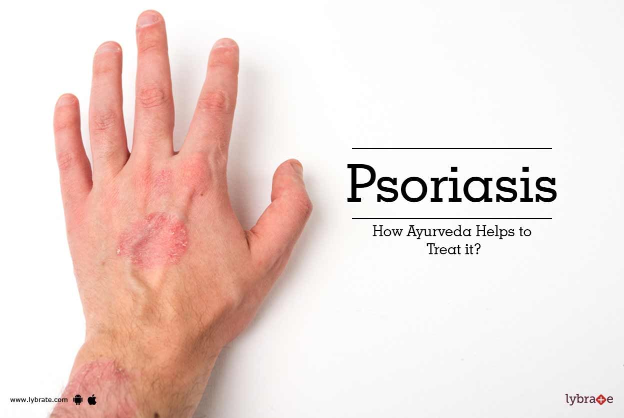 Psoriasis - How Ayurveda Helps to Treat it?