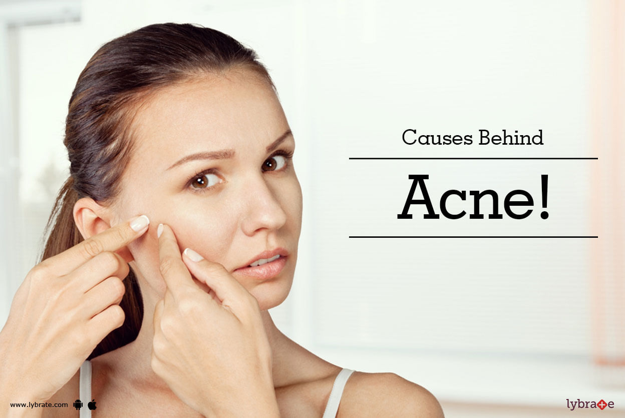 Causes Behind Acne!