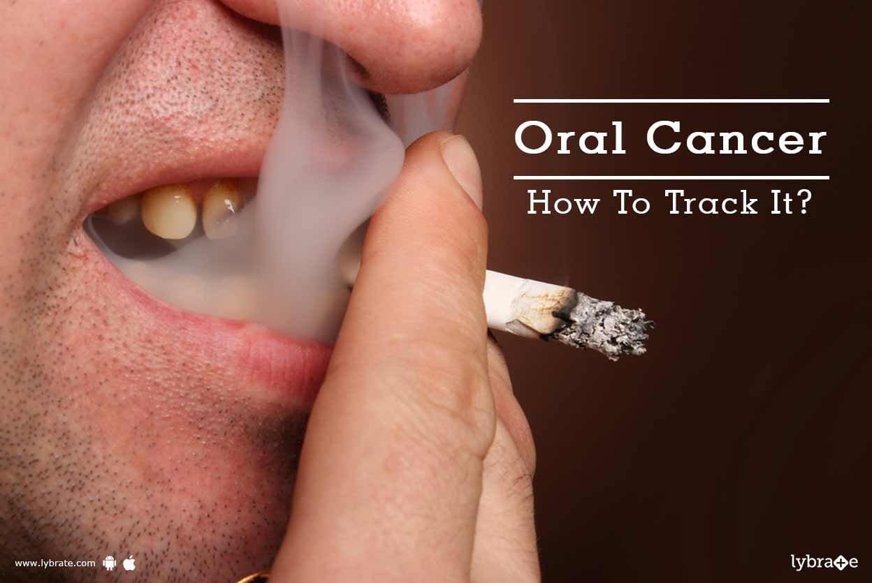 Oral Cancer - How To Track It?