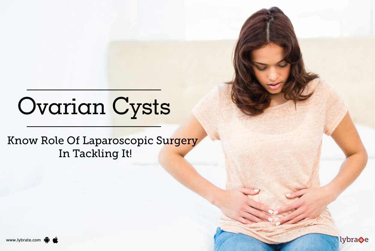 Ovarian Cysts - Know Role Of Laparoscopic Surgery In Tackling It!