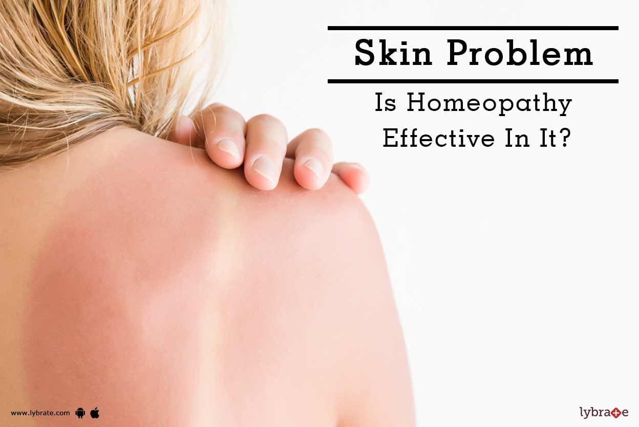 Skin Problem - Is Homeopathy Effective In It?