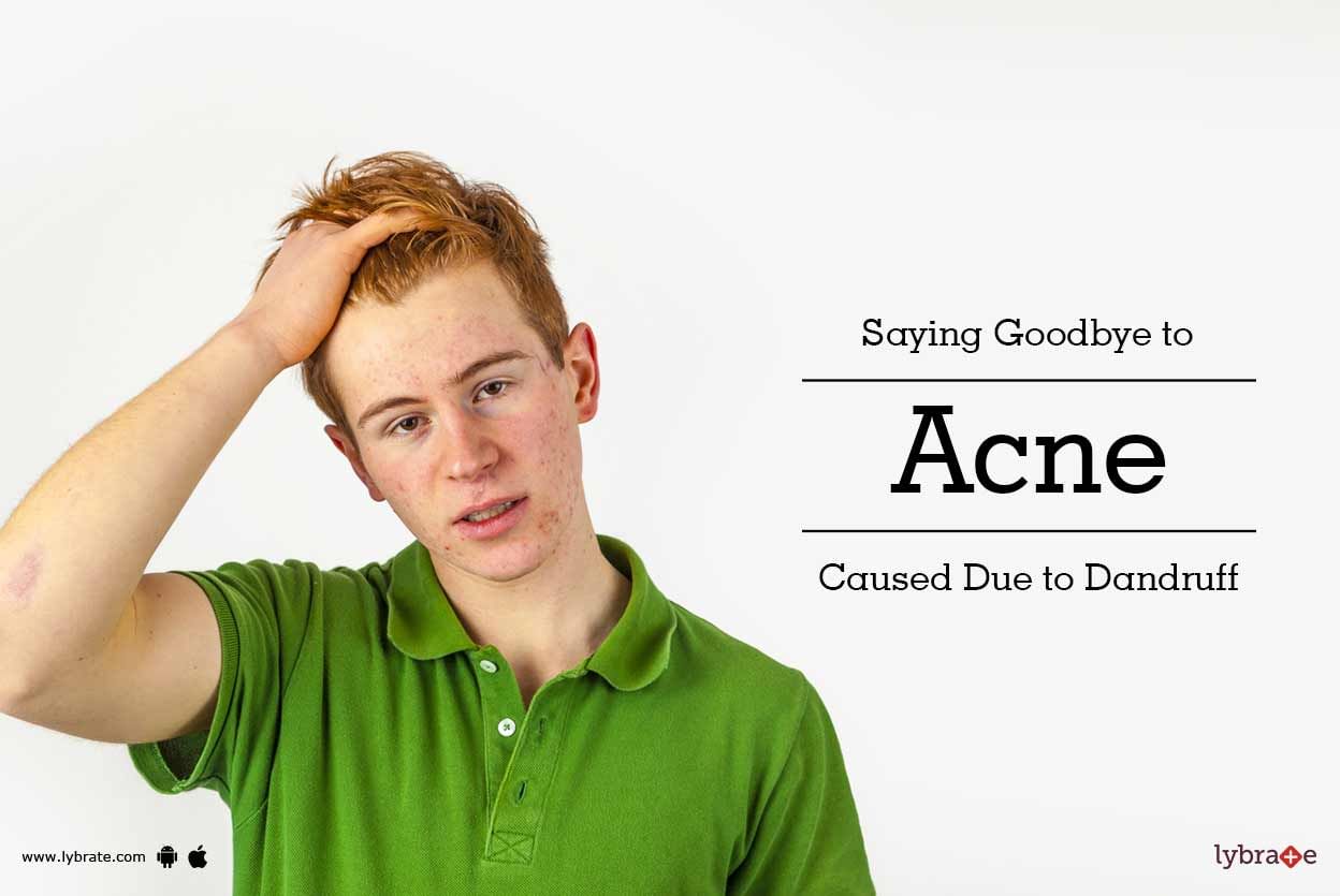 Saying Goodbye to Acne Caused Due to Dandruff