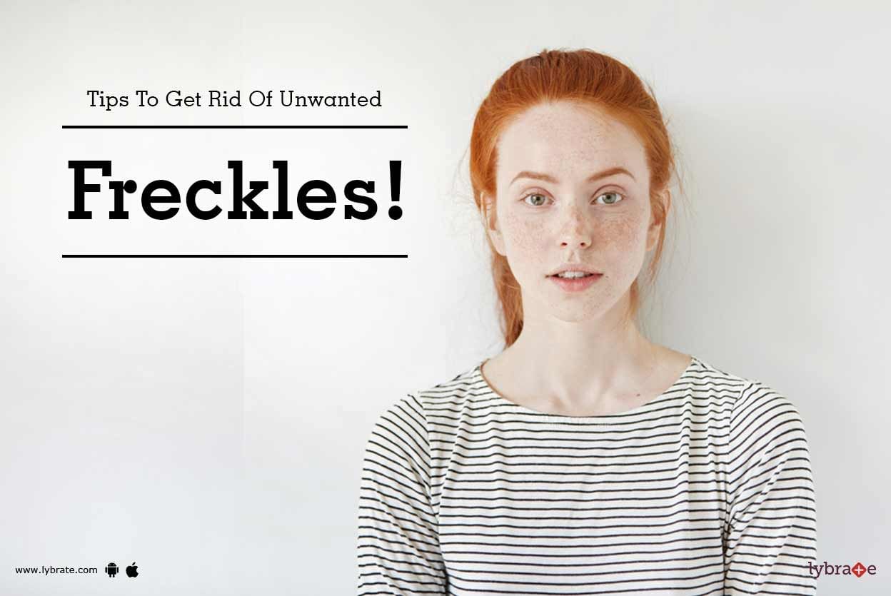 Tips To Get Rid Of Unwanted Freckles!