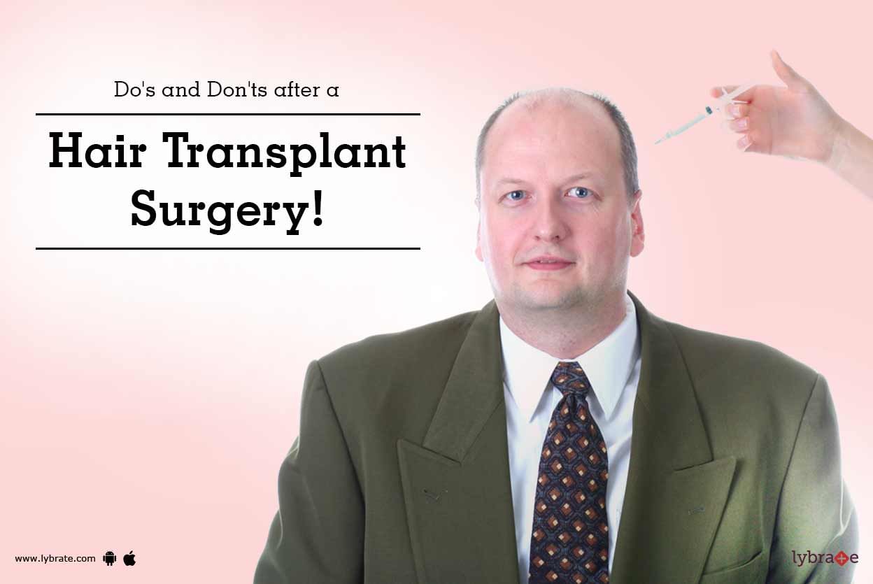 Do's and Don'ts after a Hair Transplant Surgery!