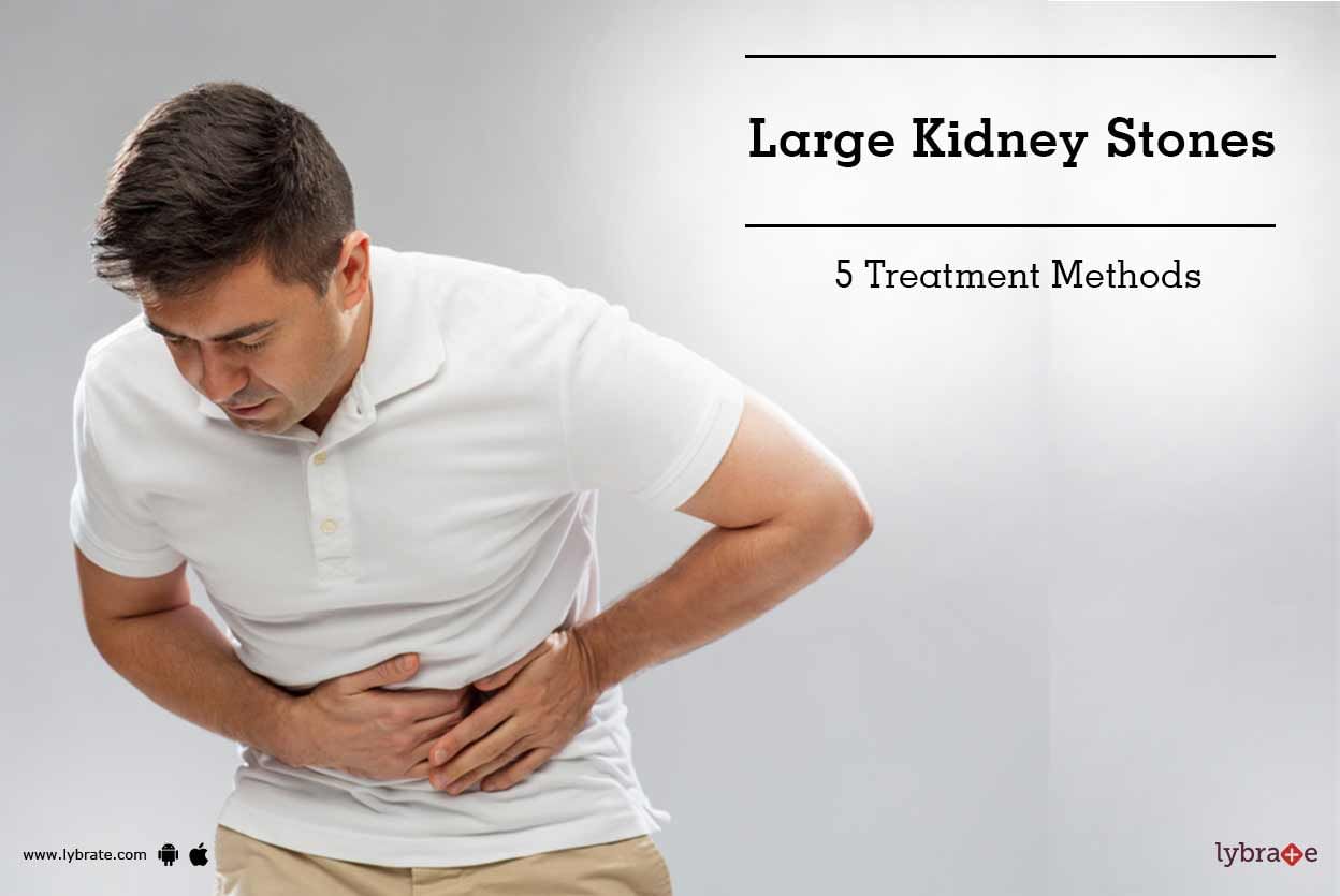 Large Kidney Stones - 5 Treatment Methods