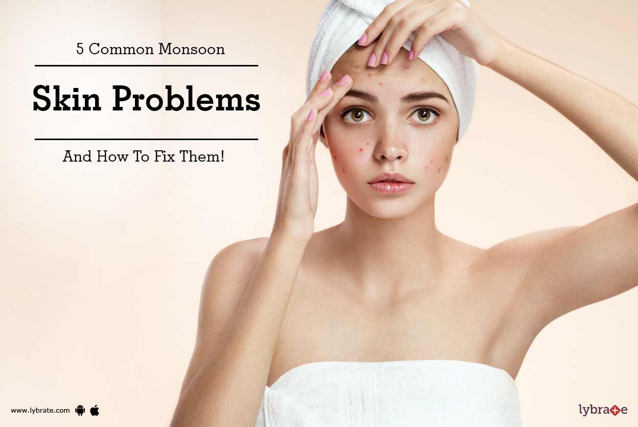 5 Common Monsoon Skin Problems And How To Fix Them!