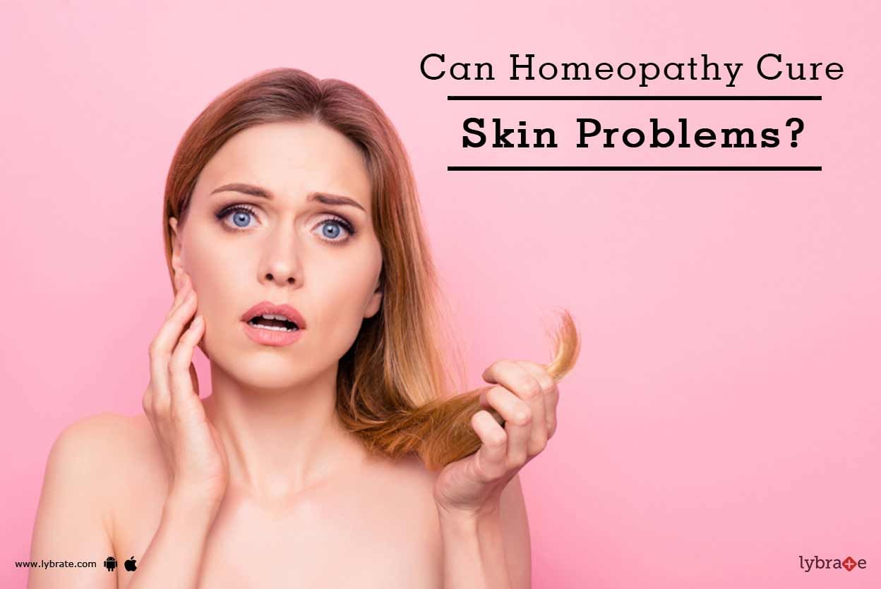 Can Homeopathy Cure Skin Problems?