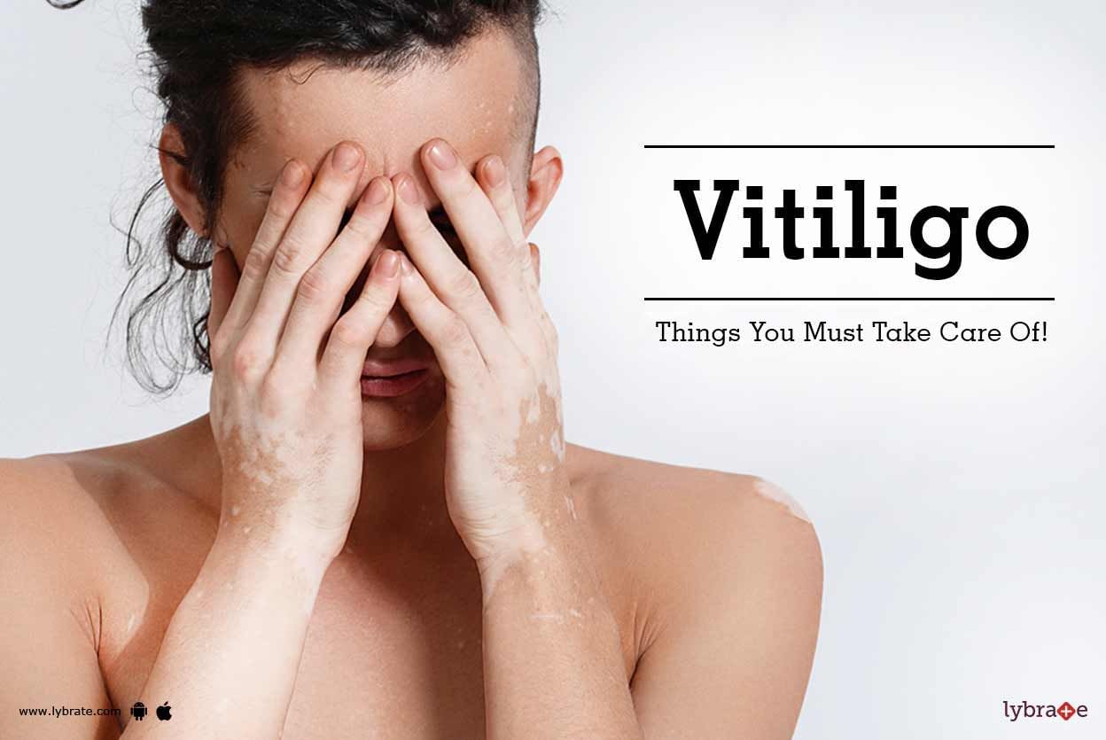 Vitiligo - Things You Must Take Care Of!