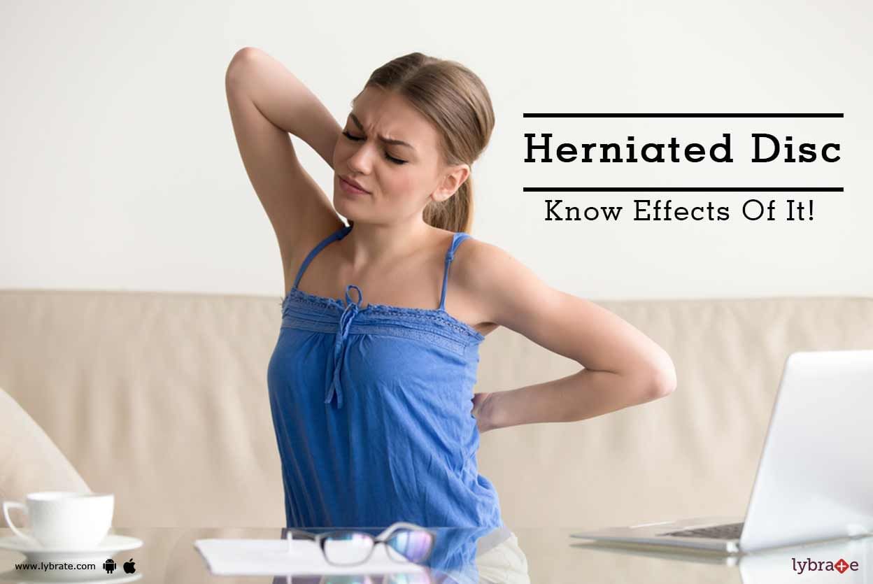 Herniated Disc - Know Effects Of It!
