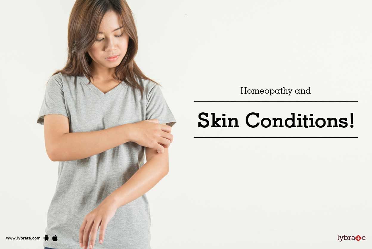 Homeopathy and Skin Conditions!