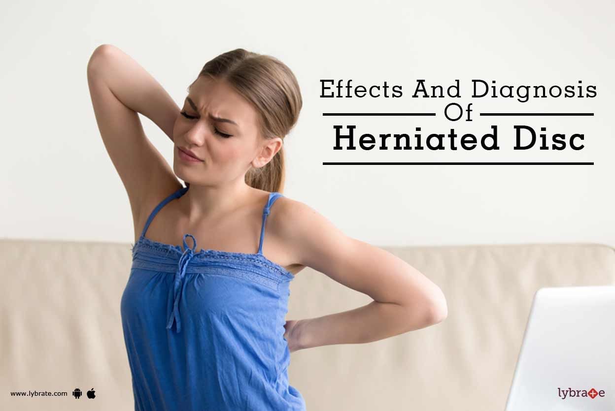 Effects And Diagnosis Of Herniated Disc