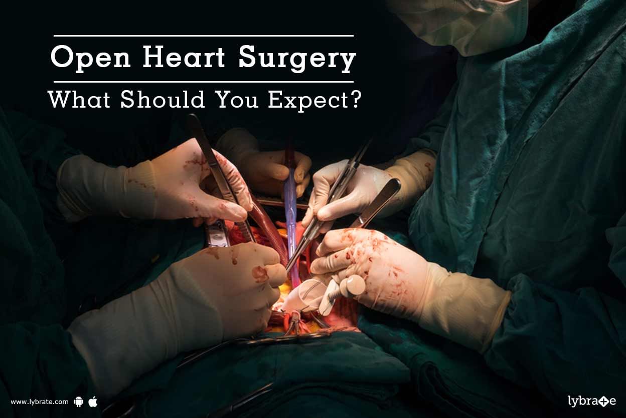 Open Heart Surgery - What Should You Expect?