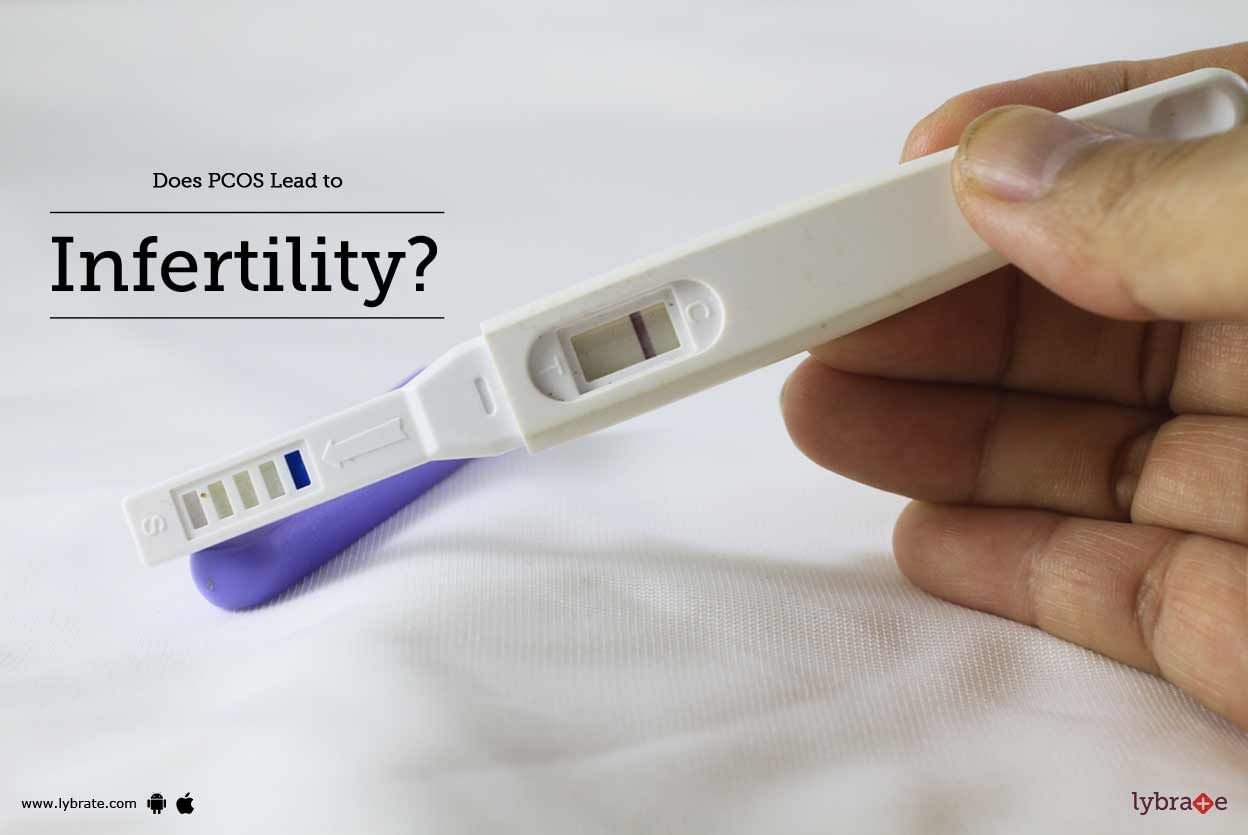 Does PCOS Lead to Infertility?