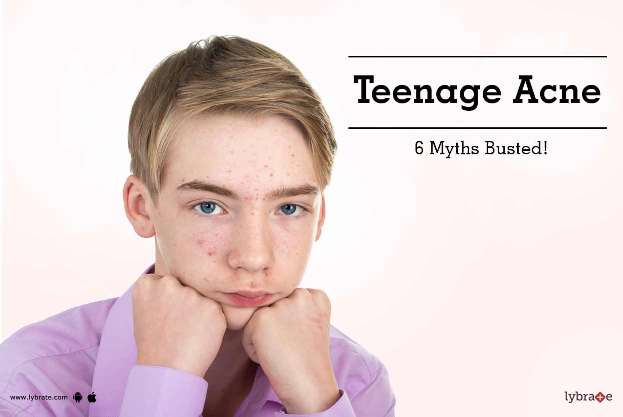 Teenage Acne - 6 Myths Busted!