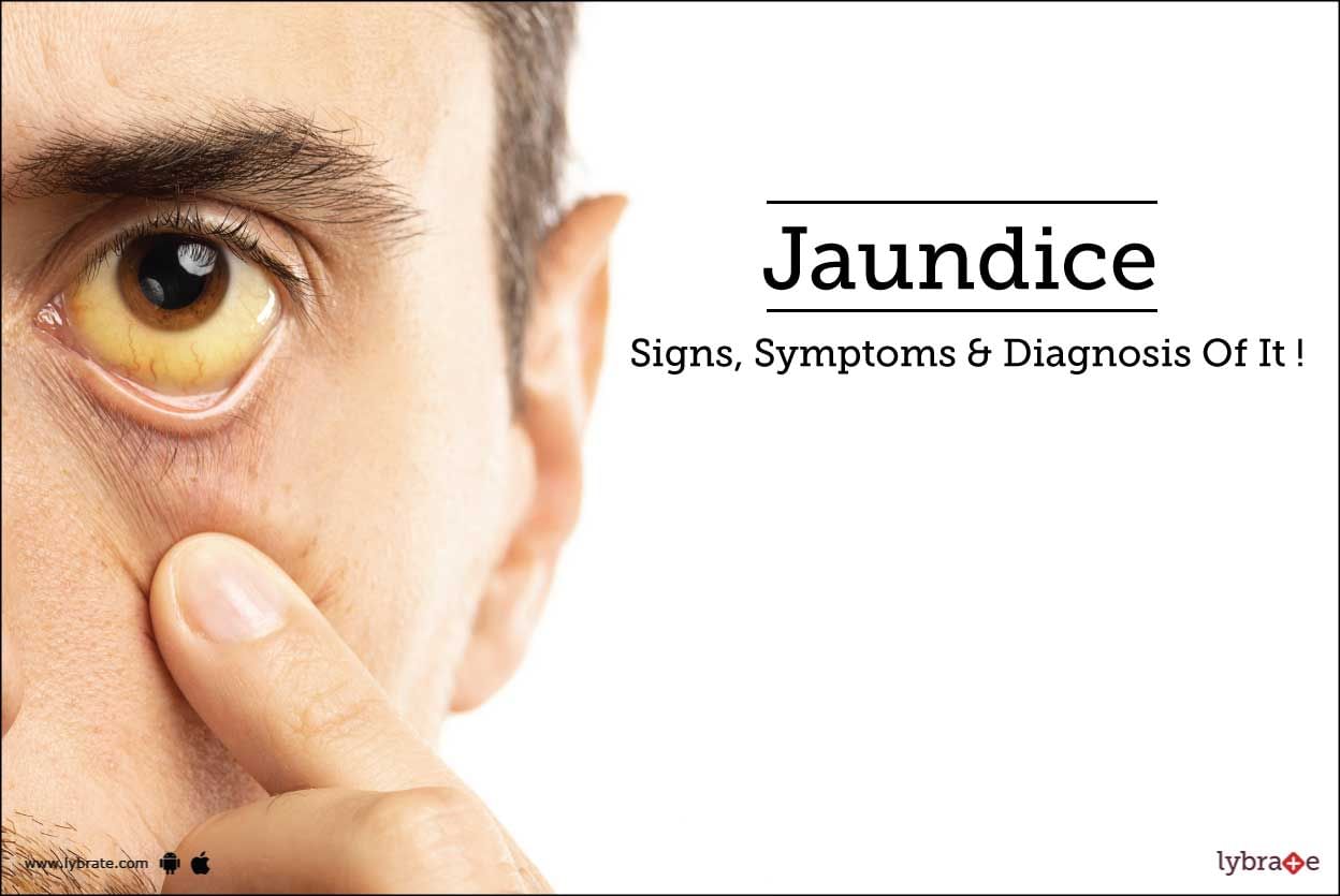 Jaundice - Signs, Symptoms & Diagnosis Of It!
