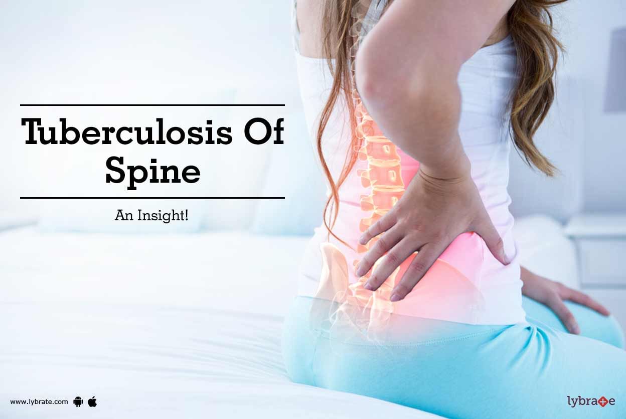 Tuberculosis Of Spine - An Insight!