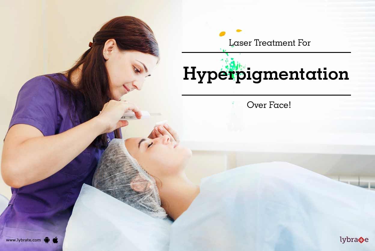 Laser Treatment For Hyperpigmentation Over Face!