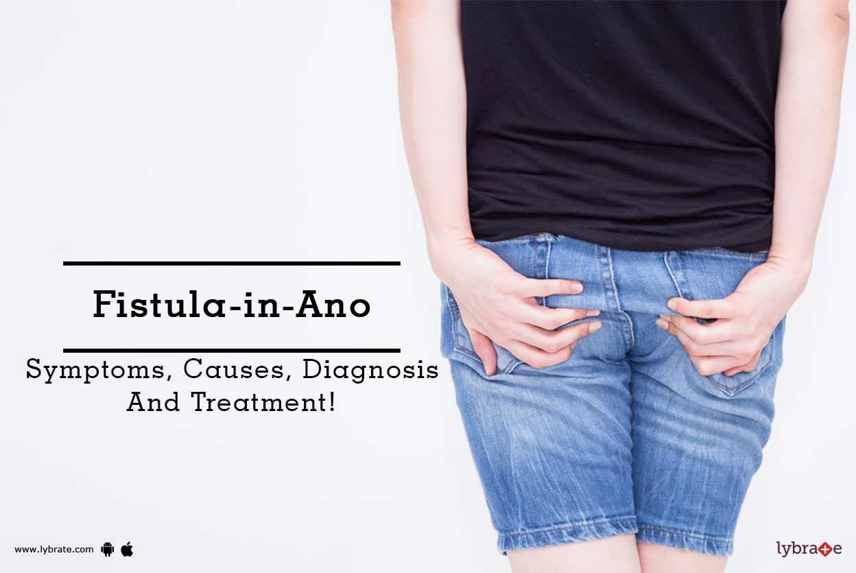 Fistula-in-Ano - Symptoms, Causes, Diagnosis And Treatment!