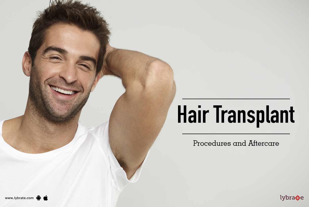 Hair Transplant: Procedures and Aftercare