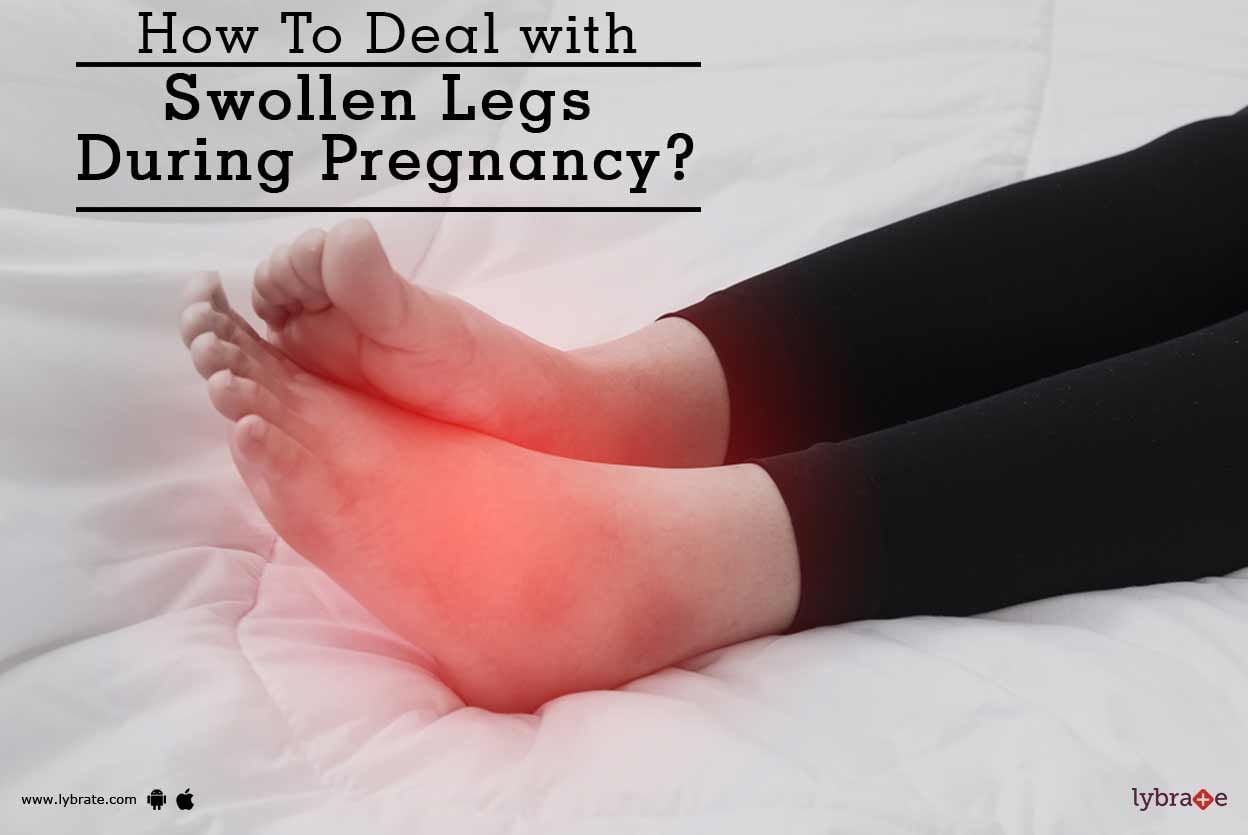 How To Deal with Swollen Legs During Pregnancy?