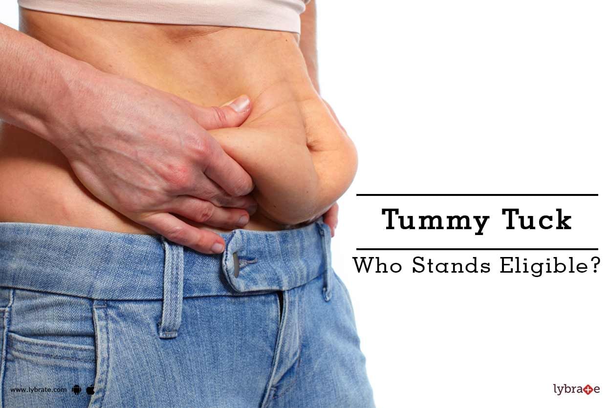Tummy Tuck - Who Stands Eligible?