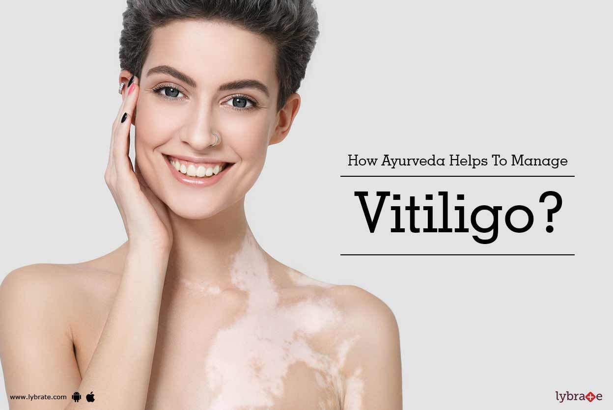 How Ayurveda Helps To Manage Vitiligo?