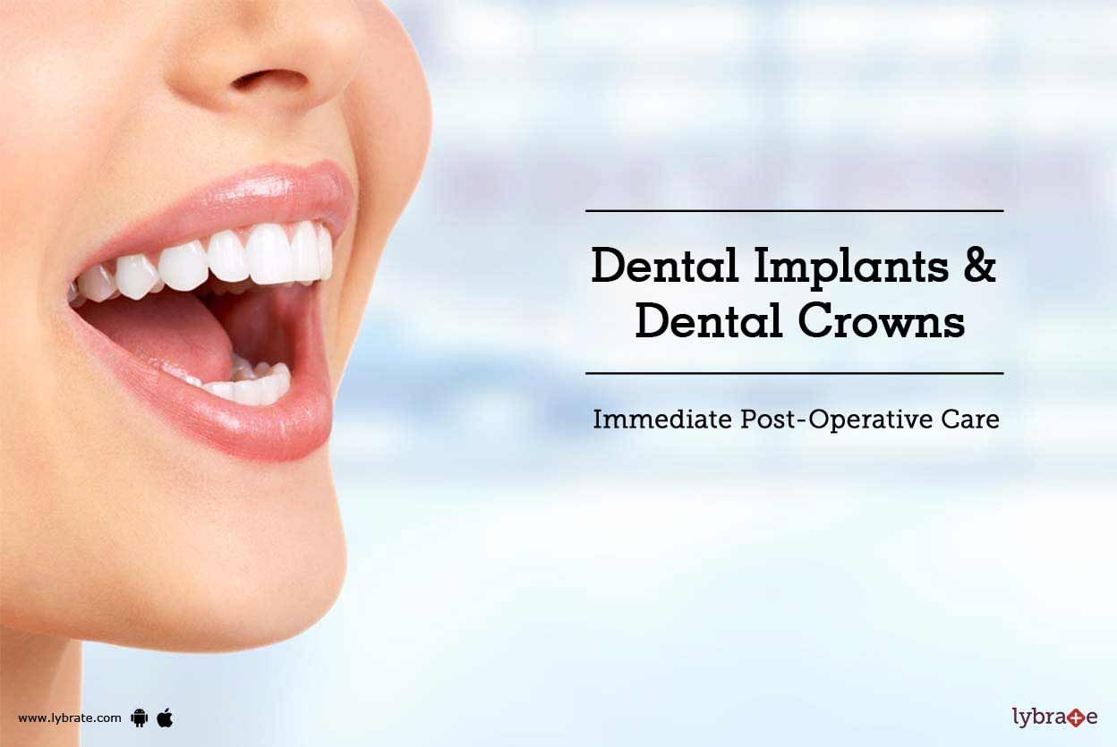Dental Implants & Dental Crowns - Immediate Post-operative Care