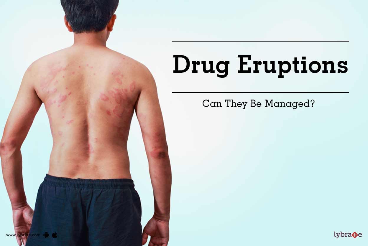 Drug Eruptions - Can They Be Managed?