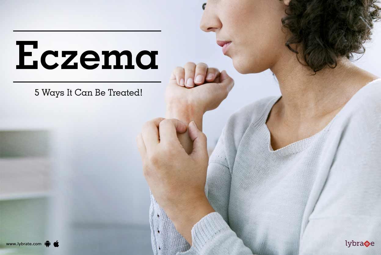 Eczema - 5 Ways It Can Be Treated!