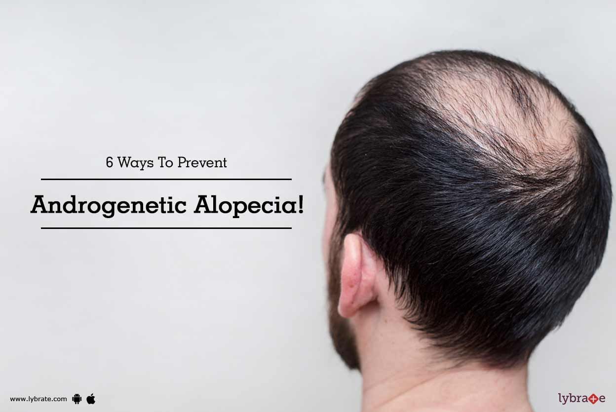 6 Ways To Prevent Androgenetic Alopecia!