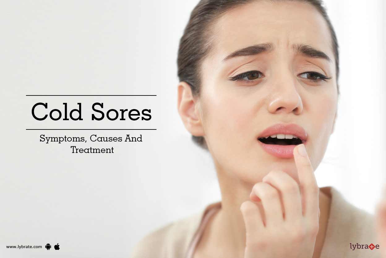 Cold Sores - Symptoms, Causes And Treatment