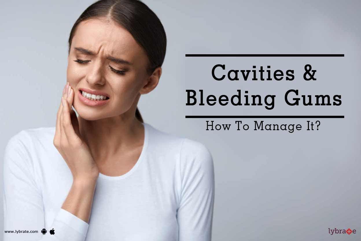 Cavities & Bleeding Gums - How To Manage It?
